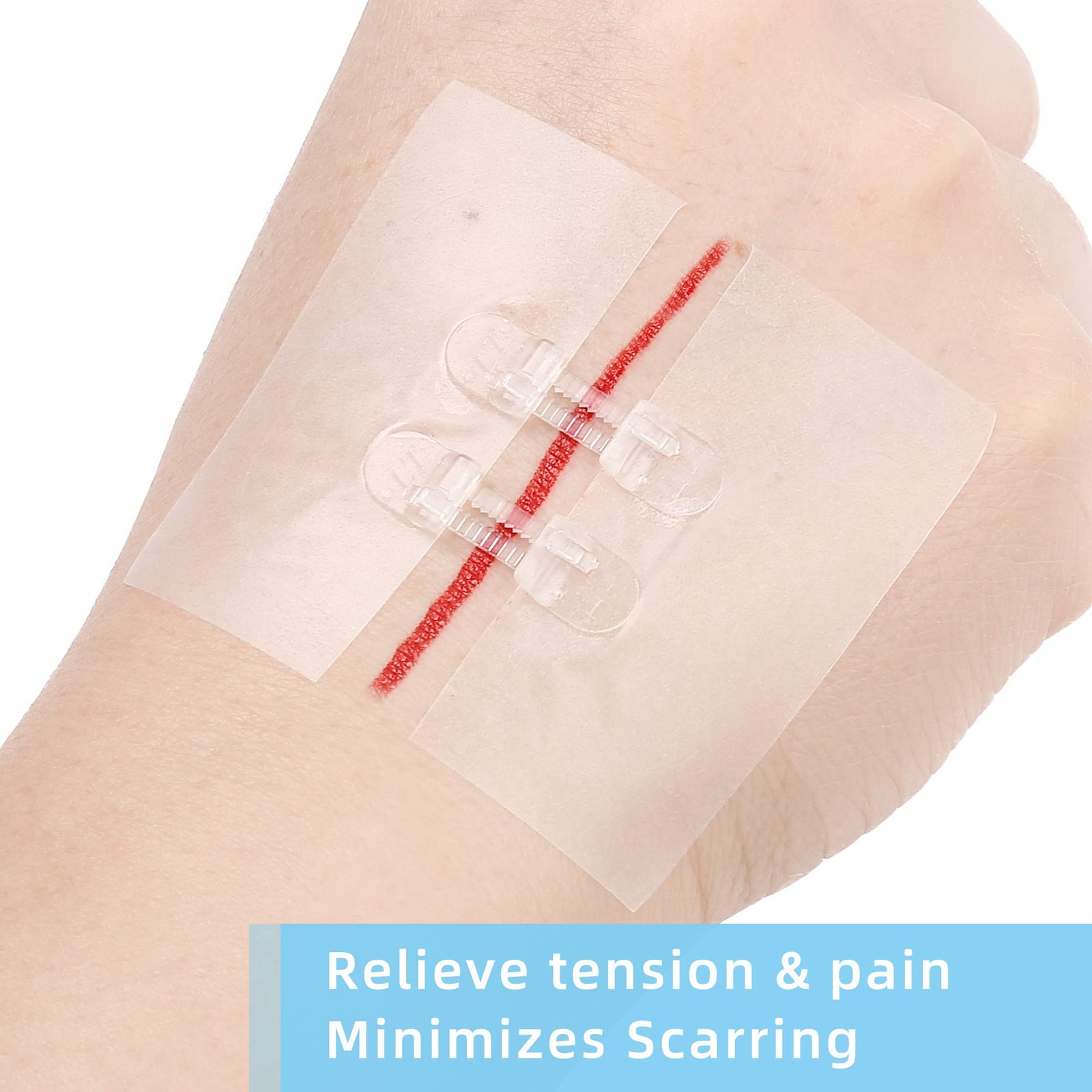 Emergency Wound Closure Strips Kit, 4 Sterile Zip-Style Closures