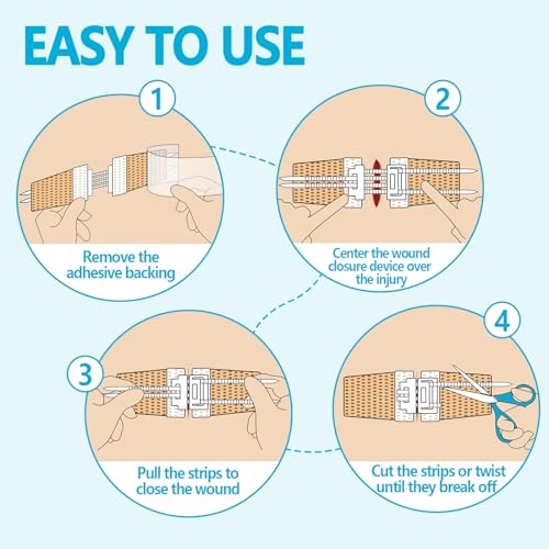 Wound Closure Device 4 Pcs – Zip Sutures & Butterfly Bandage | Non-woven 4 PCS
