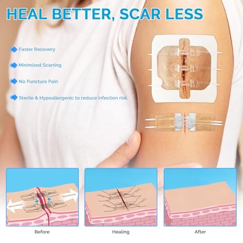 Emergency Wound Closure Strips – 16 Pack Laceration Closure Kit with 2 Types