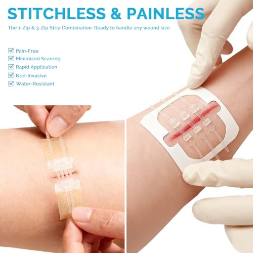 Emergency Wound Closure Strips – 16 Pack Laceration Closure Kit with 2 Types