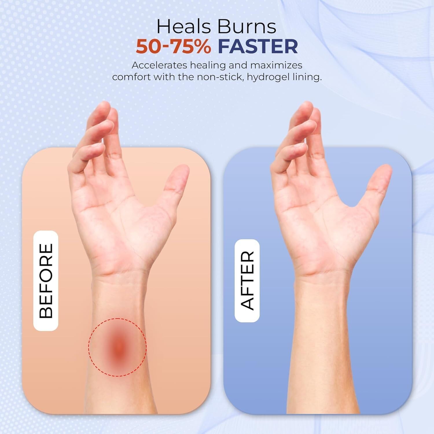 BurnFIX® Burn Kit First Aid Recommended by Doctors, Comprehensive 25pcs First…