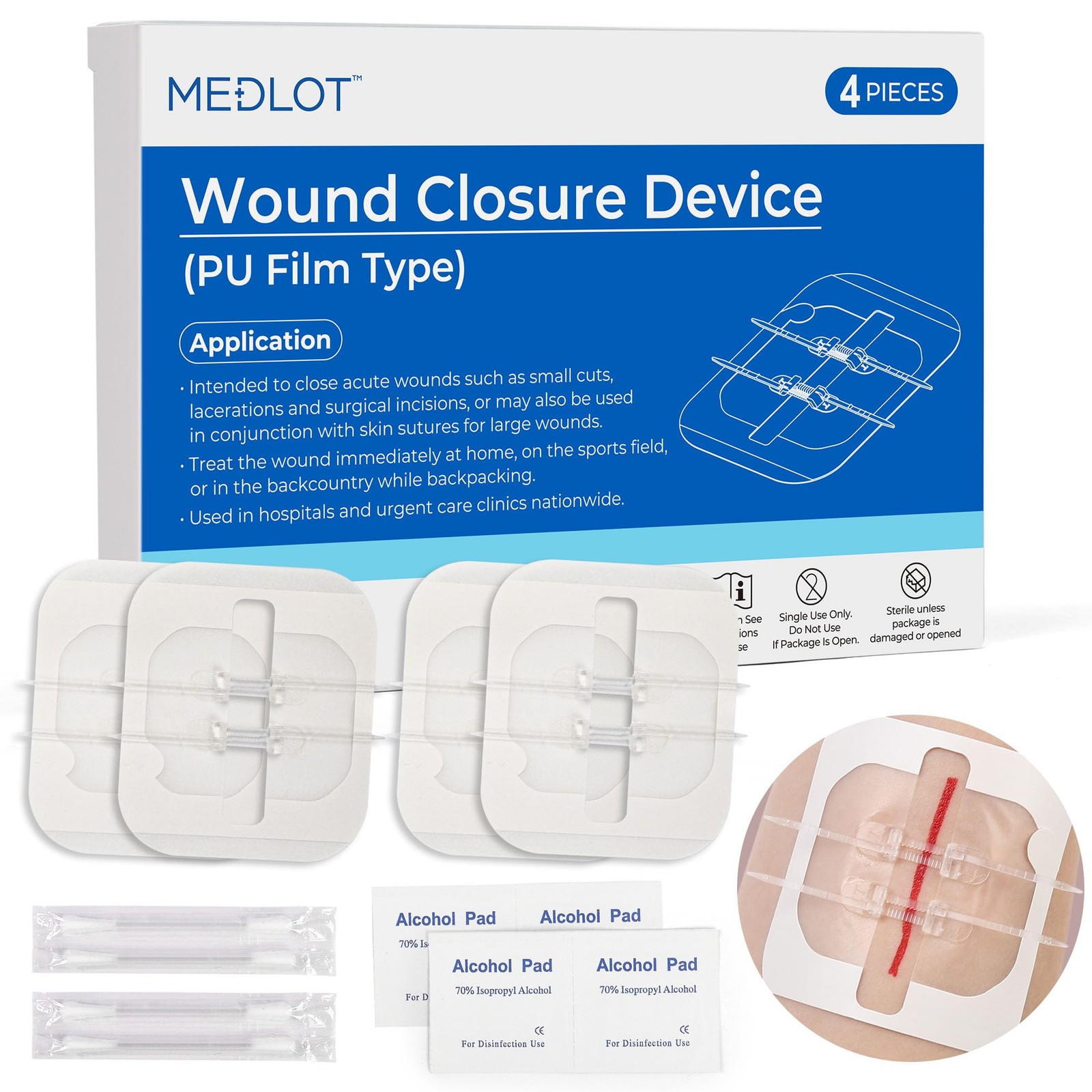 Emergency Wound Closure Strips Kit, 4 Sterile Zip-Style Closures