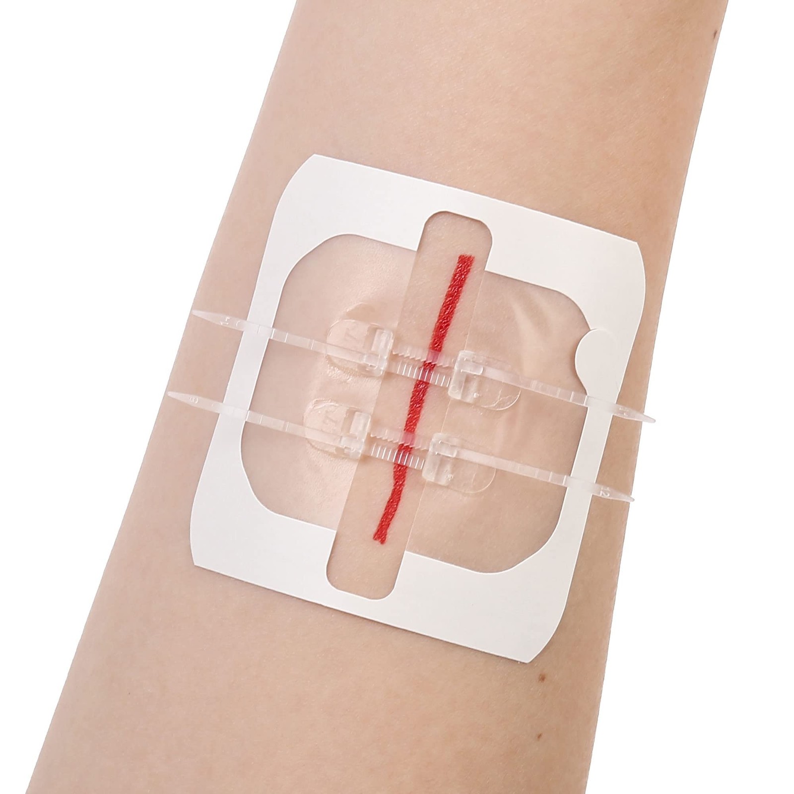 LotFancy Emergency Wound Closures, 4-Count, First Aid Supplies, Medical 4PCS
