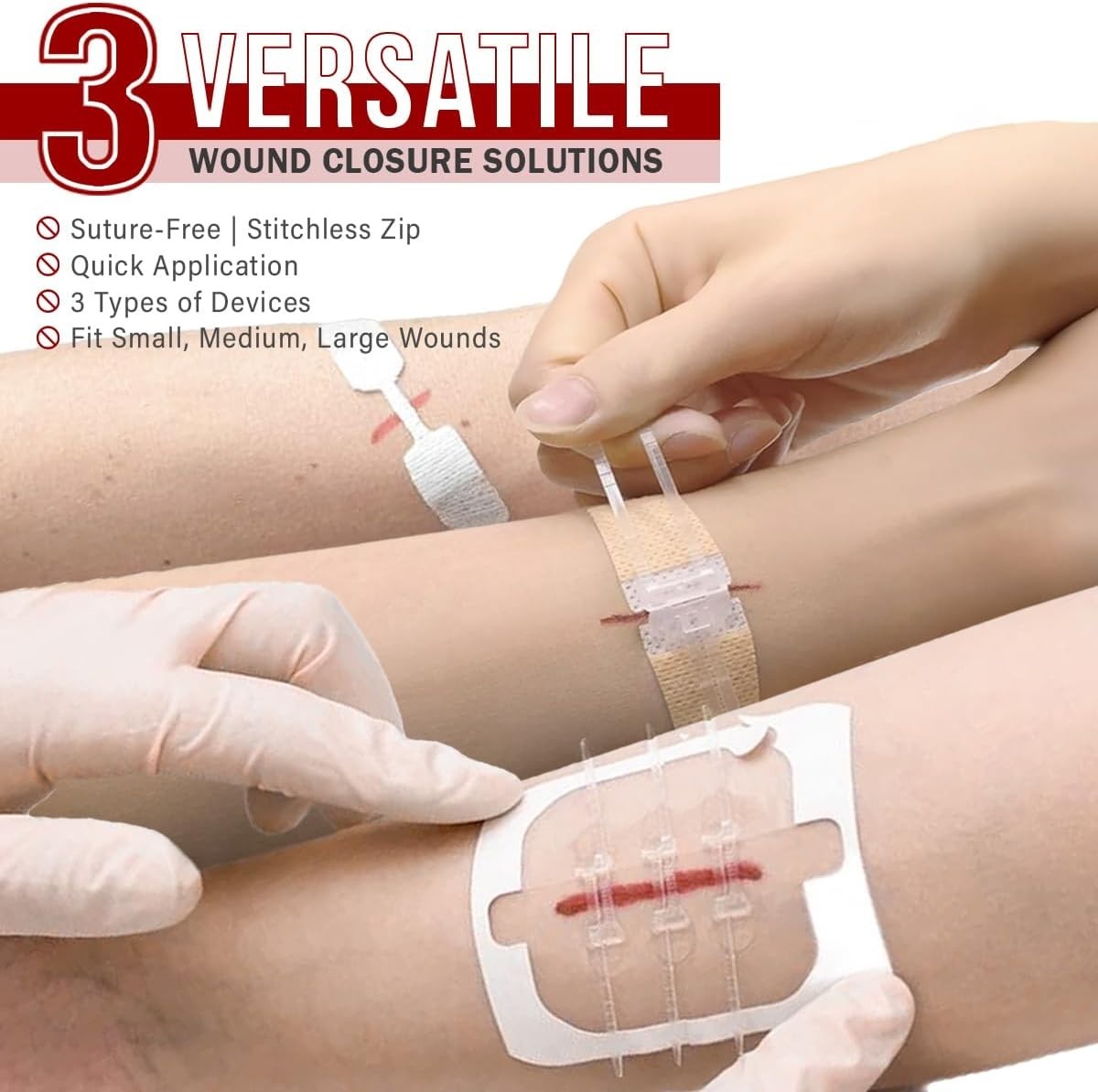 All-in-One 28 Pcs Wound Closure Kit with Suture-Free Zip Devices & Bandages