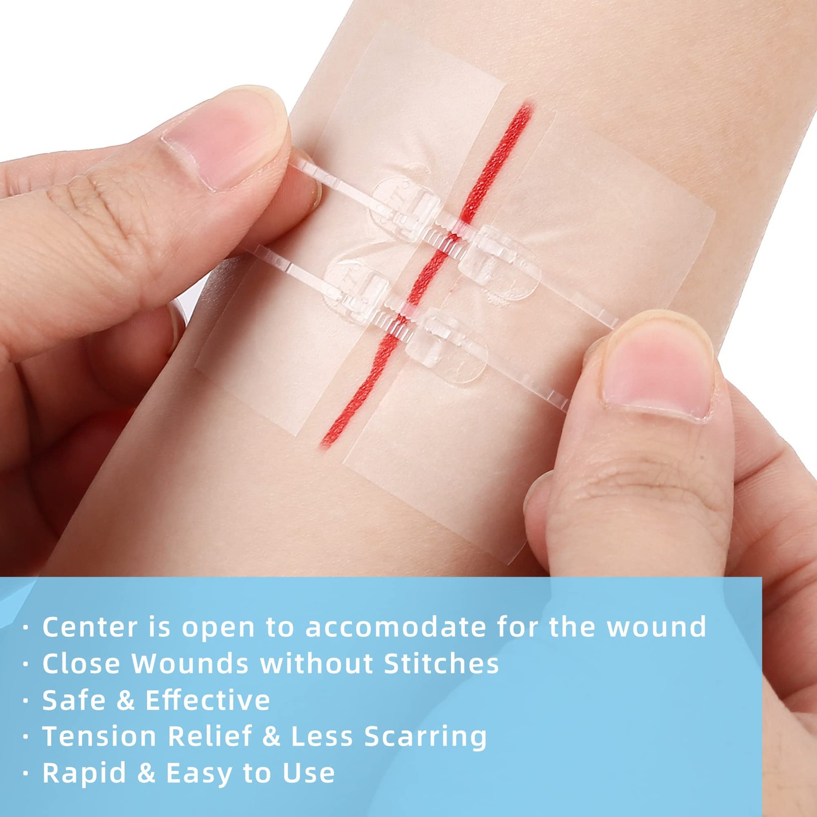 LotFancy Emergency Wound Closures, 4-Count, First Aid Supplies, Medical 4PCS
