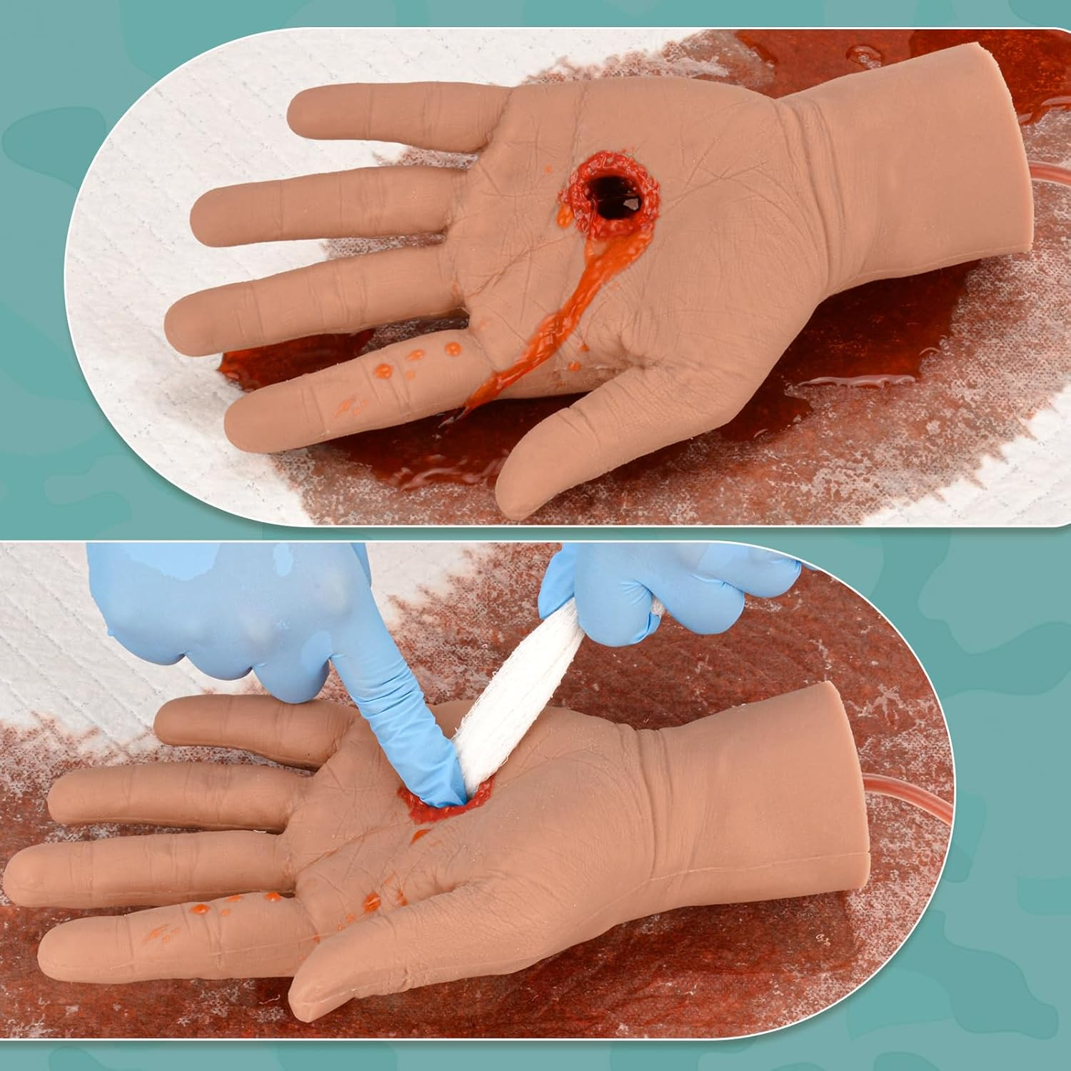 Hand Wound Packing Trainer Kit for Stop the Bleed Medical Training
