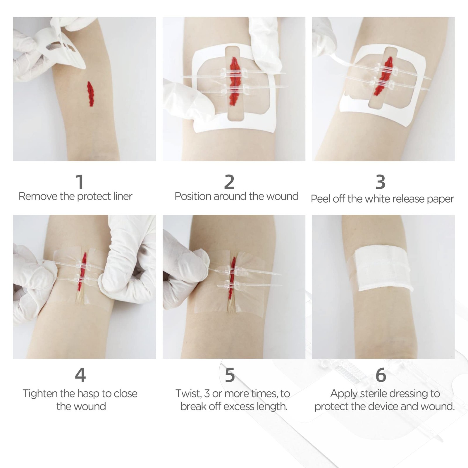 LotFancy Emergency Wound Closures, 4-Count, First Aid Supplies, Medical 4PCS