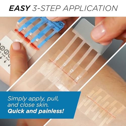 Emergency Laceration Kit – Repair Wounds Without 1.5 Inch (Pack of 1)