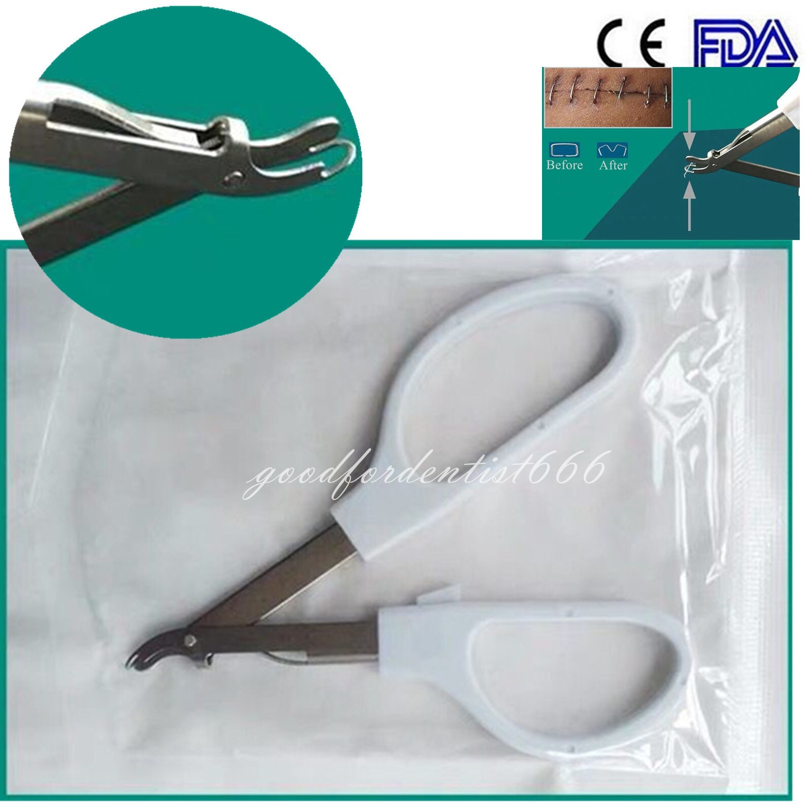 Disposable Skin Stapler Removal Tool Surgical Sterile Skin Staplers Nail Remover